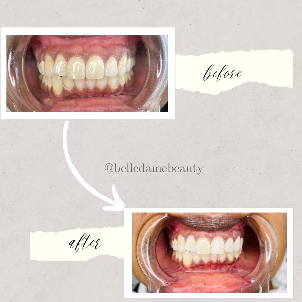 Belle Dame Beauty Logo
